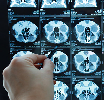 25+ years of experience